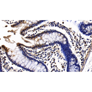 Toll Like Receptor 1 (TLR1) Human Polyclonal Antibody