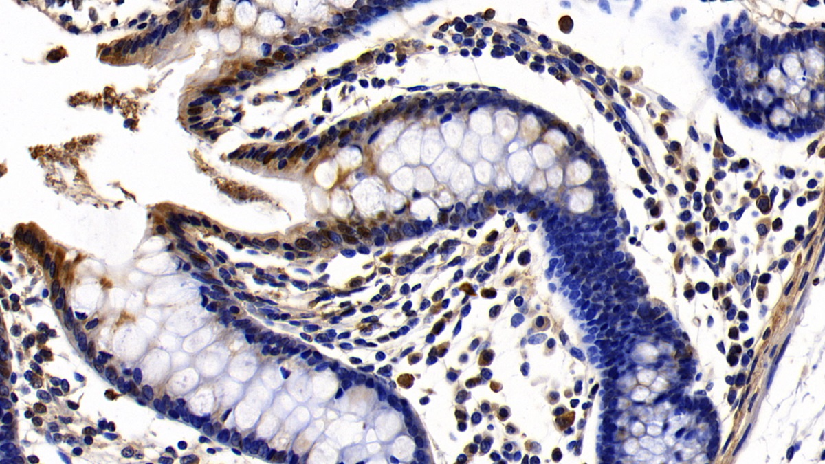 Toll Like Receptor 1 (TLR1) Human Polyclonal Antibody