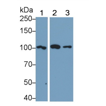 Toll Like Receptor 5 (TLR5) Human Polyclonal Antibody