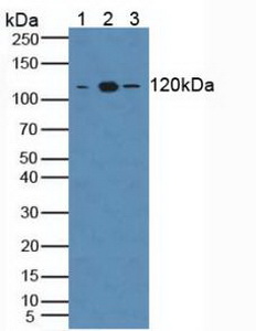 Toll Like Receptor 8 (TLR8) Human Polyclonal Antibody