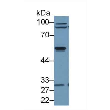Arrestin Beta 2 (ARRb2) Human Polyclonal Antibody