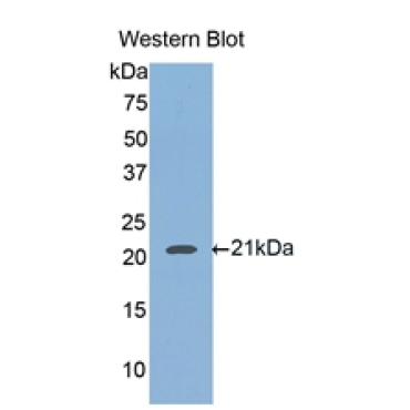 Hemojuvelin (HJV) Human Polyclonal Antibody