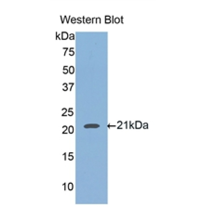 Hemojuvelin (HJV) Human Polyclonal Antibody