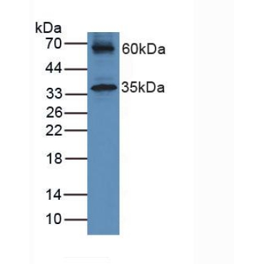 Hemojuvelin (HJV) Human Polyclonal Antibody