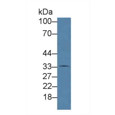 Hemojuvelin (HJV) Human Polyclonal Antibody
