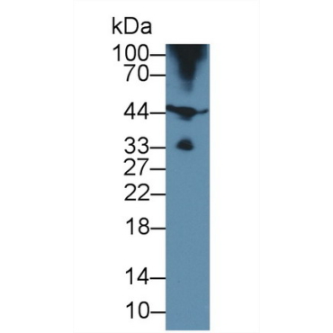 Hemojuvelin (HJV) Human Polyclonal Antibody