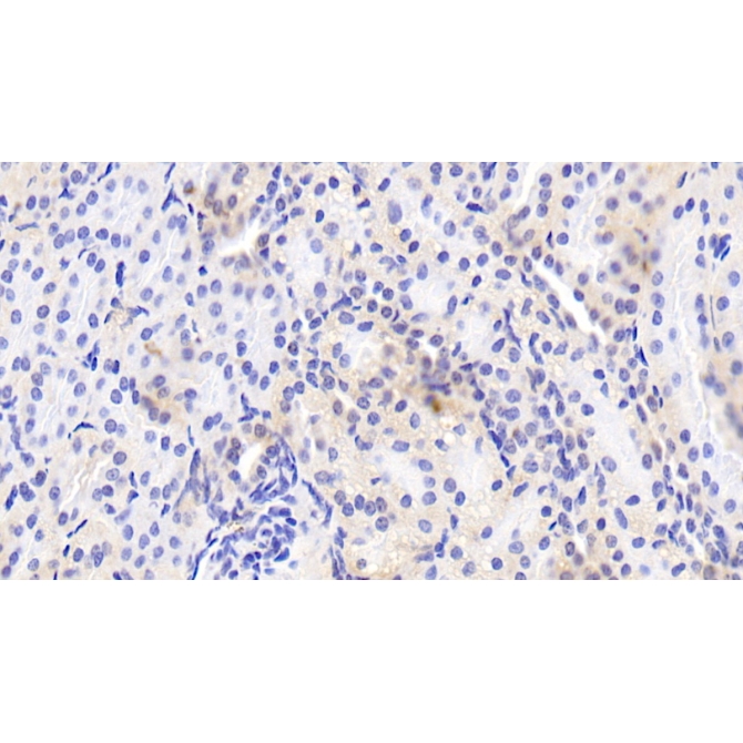 Hemojuvelin (HJV) Human Polyclonal Antibody