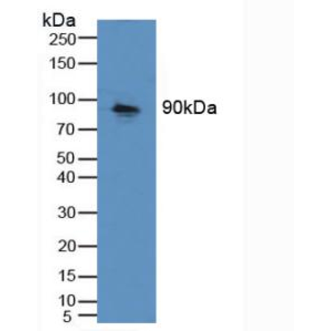 Cadherin 16 (CDH16) Human Polyclonal Antibody