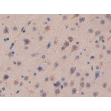 Cadherin 16 (CDH16) Mouse Polyclonal Antibody