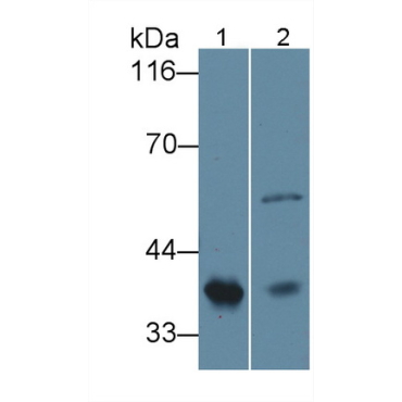 Haptoglobin Related Protein (HPR) Human Polyclonal Antibody