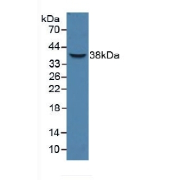 Haptoglobin Related Protein (HPR) Human Polyclonal Antibody