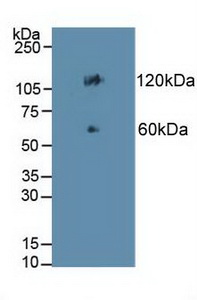 Cadherin 17 (CDH17) Human Polyclonal Antibody