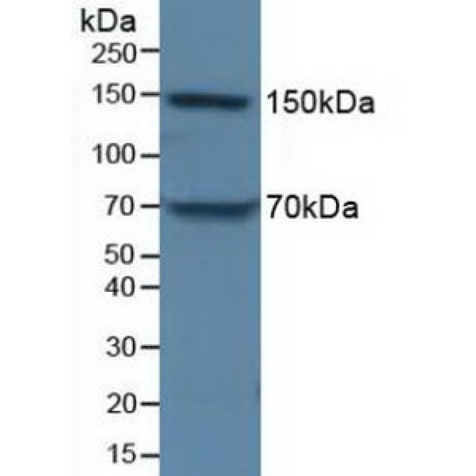 Apolipoprotein B (APOB) Human Polyclonal Antibody
