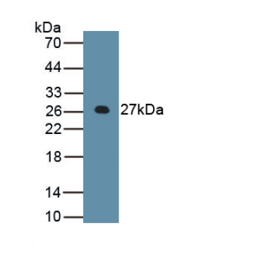 Apolipoprotein B (APOB) Human Polyclonal Antibody