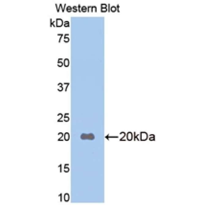 Apolipoprotein B (APOB) Mouse Polyclonal Antibody