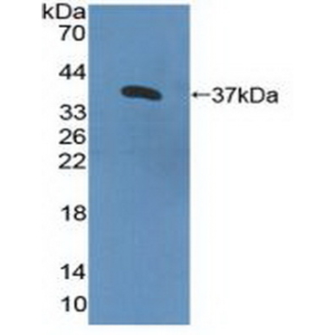 Interleukin 8 Receptor Beta (IL8Rb) Human Polyclonal Antibody