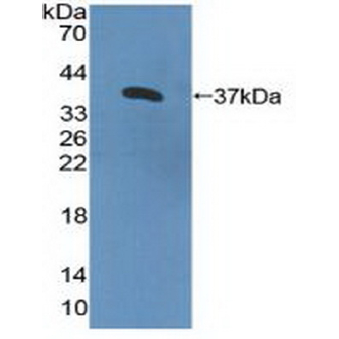 Interleukin 8 Receptor Beta (IL8Rb) Human Polyclonal Antibody