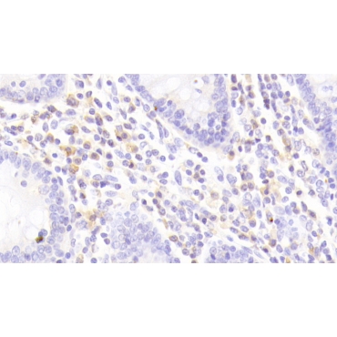 Interleukin 8 Receptor Beta (IL8Rb) Human Polyclonal Antibody