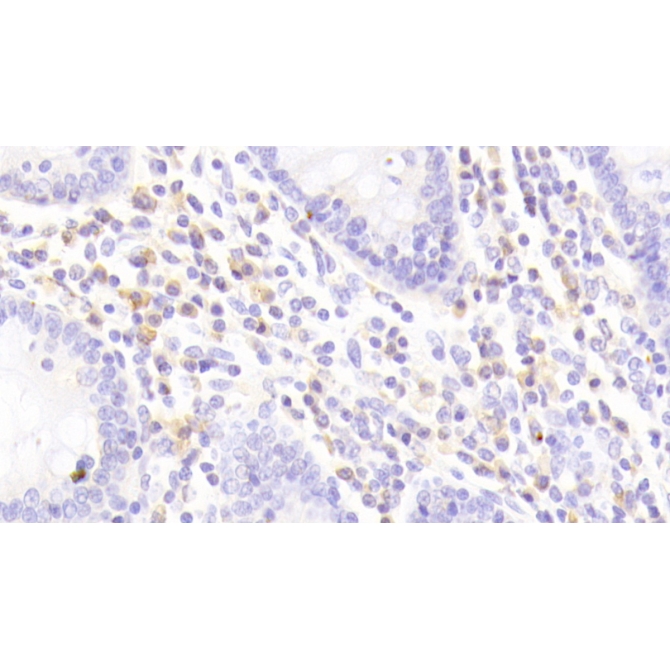 Interleukin 8 Receptor Beta (IL8Rb) Human Polyclonal Antibody