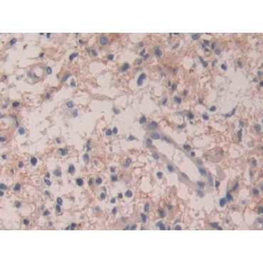 Interleukin 35 (IL35) Human Polyclonal Antibody