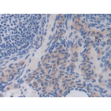 Interleukin 35 (IL35) Mouse Polyclonal Antibody