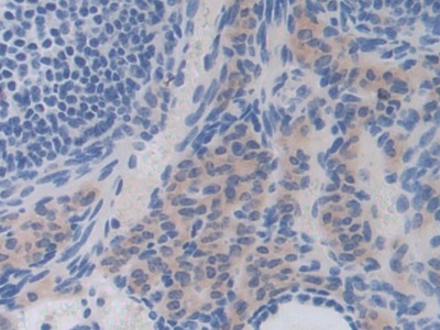 Interleukin 35 (IL35) Mouse Polyclonal Antibody
