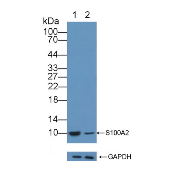S100 Calcium Binding Protein A2 (S100A2) Human Polyclonal Antibody