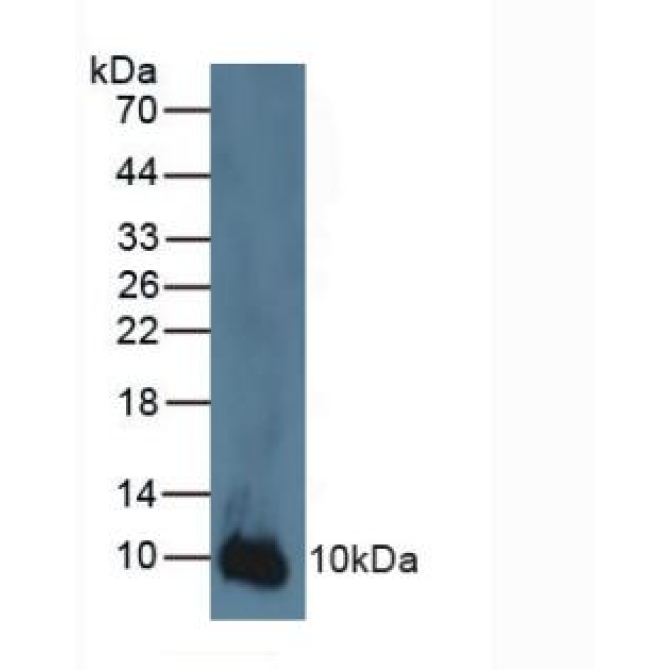 S100 Calcium Binding Protein A2 (S100A2) Human Polyclonal Antibody