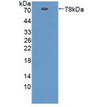 Serpin A10 (SERPINA10) Human Polyclonal Antibody