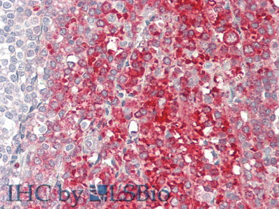 Complement Factor B (CFB) Human Polyclonal Antibody