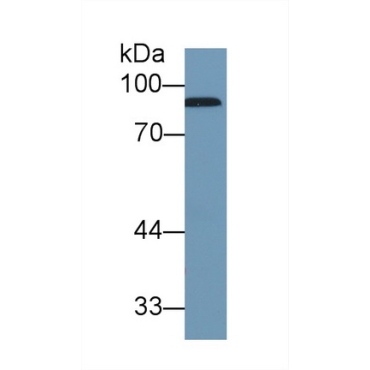 Complement Factor B (CFB) Human Polyclonal Antibody