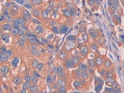 Complement Factor B (CFB) Human Polyclonal Antibody