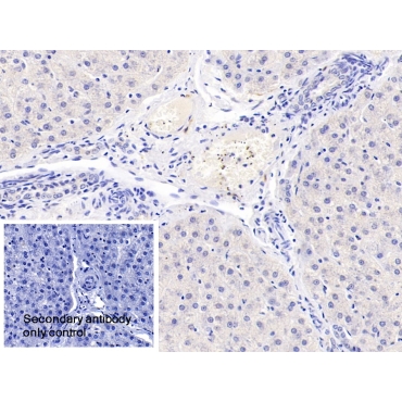 Complement Factor B (CFB) Human Polyclonal Antibody
