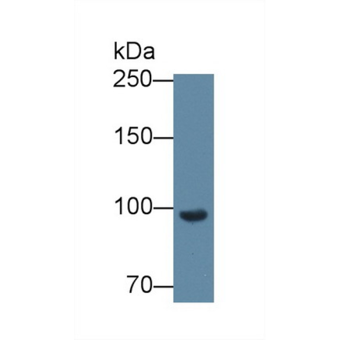 Complement Factor B (CFB) Mouse Polyclonal Antibody