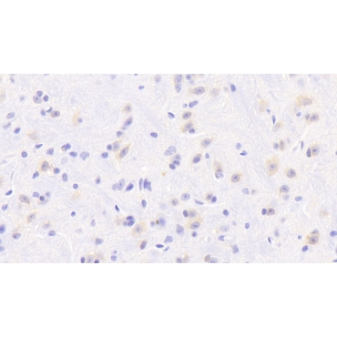 Dihydropyrimidine Dehydrogenase (DPYD) Mouse Polyclonal Antibody