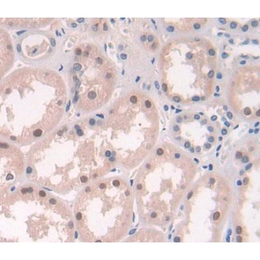 Xeroderma Pigmentosum, Complementation Group D (XPD) Human Polyclonal Antibody