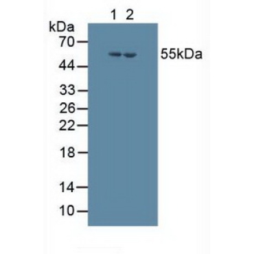 Cytochrome P450 17A1 (CYP17A1) Human Polyclonal Antibody