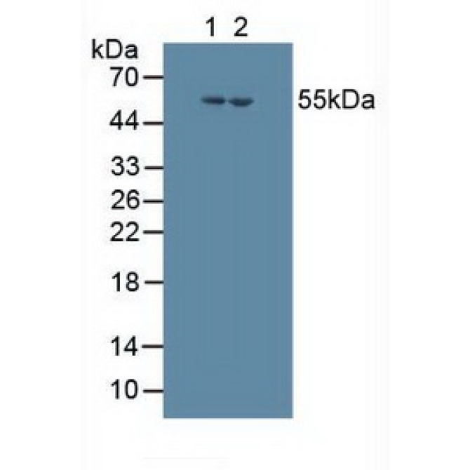 Cytochrome P450 17A1 (CYP17A1) Human Polyclonal Antibody