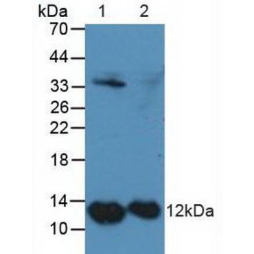 S100 Calcium Binding Protein A4 (S100A4) Human Polyclonal Antibody
