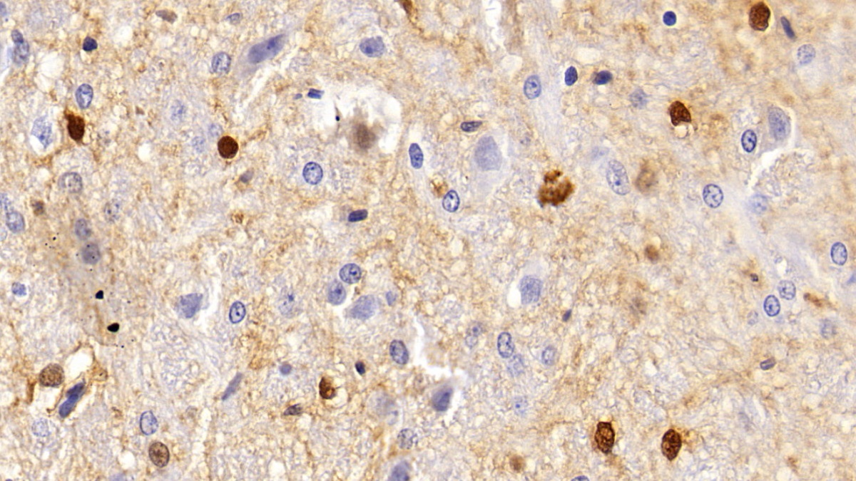 S100 Calcium Binding Protein A5 (S100A5) Rat Polyclonal Antibody