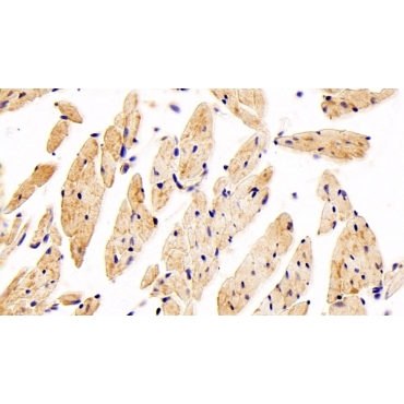 Glucose Transporter 4 (GLUT4) Human Polyclonal Antibody