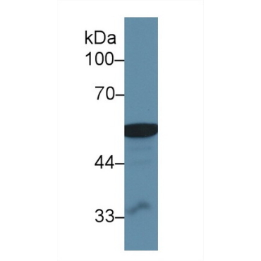 Aldehyde Dehydrogenase, Mitochondrial (ALDH2) Human Polyclonal Antibody