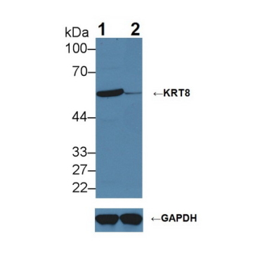 Cytokeratin 8 (CK8) Human Polyclonal Antibody