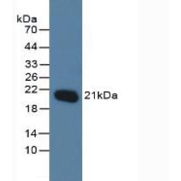 O-6-Methylguanine DNA Methyltransferase (MGMT) Human Polyclonal Antibody