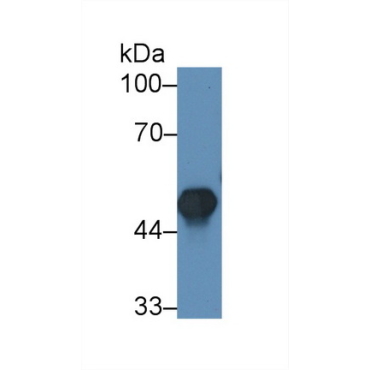 Creatine Kinase B (CK-BB) Human Polyclonal Antibody
