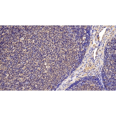Interleukin 4 Receptor (IL4R) Human Polyclonal Antibody