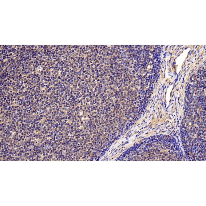 Interleukin 4 Receptor (IL4R) Human Polyclonal Antibody