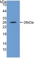 Interleukin 4 Receptor (IL4R) Rat Polyclonal Antibody