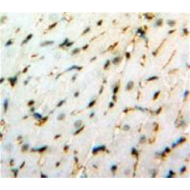 Heat Shock Protein Beta 8 (HSPb8) Human Polyclonal Antibody
