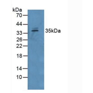 Growth Differentiation Factor 15 (GDF15) Human Polyclonal Antibody